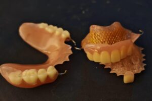 Acrylic Dentures