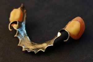 Metal Framework Dentures 