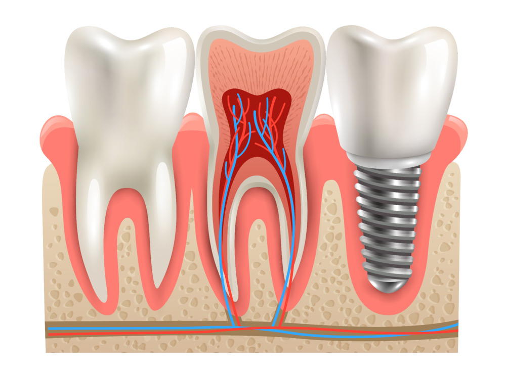 What happens after adding a temporary tooth placement